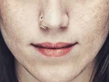how-can-i-speed-up-the-healing-of-my-nose-piercing