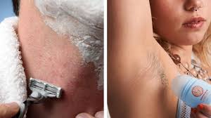 curious how to prevent ingrown hairs