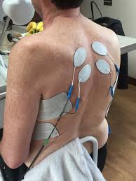 functional electrical stimulation