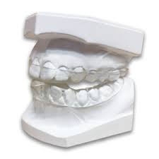 In dental splinting, teeth are joined together using a thin fibre reinforced wire thereby increasing their stability. Laboratory Made Occlusal Splints S4s Dental