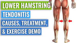 lower hamstring tendonitis causes
