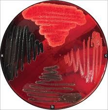 Hämta det här escherichia coli lactose positive grows on red agar endo fotot nu. View Image