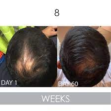 Biotin is a vitamin that is vital in helping the body breakdown various substances such as fats and carbohydrates. Biotin Vitamin Conditioner For Hair Growth Sulfate Free With Aloe V B The Product