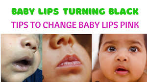 baby lip turning dark after feeding