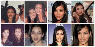kim kardashian plastic surgery journey