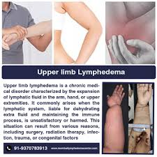 upper limb lymphedema cosmetic
