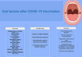 lesions after covid 19 vaccination