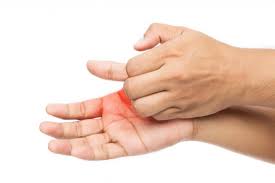 Itchy hands and feet might be a symptom of a skin disorder or another medical condition that requires treatment. Itchy Palms 6 Causes Treatment And Prevention