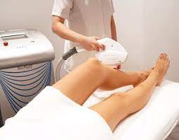 hair removal in singapore where to get