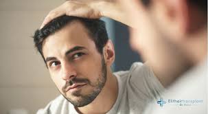 Ein leben mit haarausfall und damit entstehender glatze oder geheimratsecken kann für den einen oder anderen mann sehr belastend sein und am selbstwertgefühl knabbern. Die Problematik Der Angeborenen Geheimratsecken