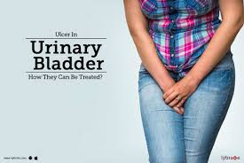 hunner s ulcer in urinary bladder how