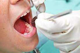 COVID Can Infect the Mouth. That Should Not Keep You Away from the Dentist  | Tufts Now