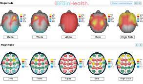 Michigan Brain Health gambar png