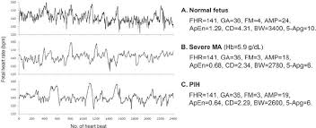 Plots Of Heart Rate Time Series Of The Normal A Severe Ma