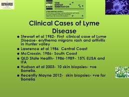 Outline     History of Lyme disease    