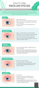 how to help swollen eyelids toronto
