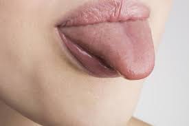swollen tongue causes symptoms and
