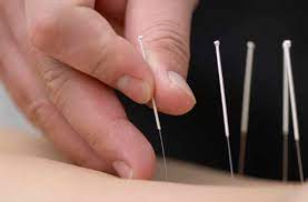 soigner la douleur par l acupuncture