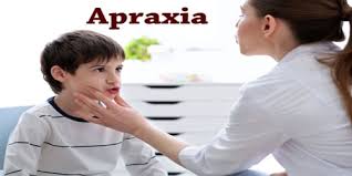 Image result for apraxia medical definition
