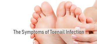 the symptoms of toenail infection