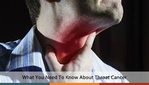 What does throat cancer look like? What You Need To Know About Throat Cancer Co Ent Colorado Springs