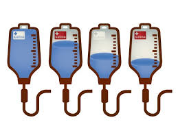 Breaking Down Iv Fluids The 4 Most Commonly Used Types