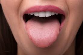 family dentist in hiram white tongue