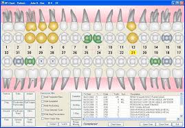 Dental Charting Symbols World Of Template Format In
