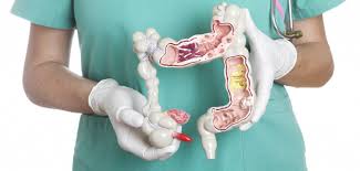 The colon in mammals can be divided into four sections: Cancer Health Basics Colon Cancer Cancer Health