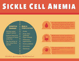 sickle cell anemia symptoms causes