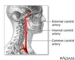 However, pain from carotidynia typically only occurs on one side. Carotid Artery Surgery Series Normal Anatomy Medlineplus Medical Encyclopedia