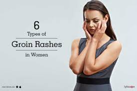 6 types of groin rashes in women