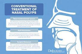 nasal polyps symptoms causes and