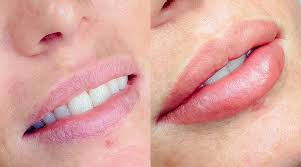 Image result for maquillaje permanente en los labios