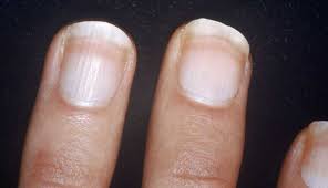your nails saying about your health