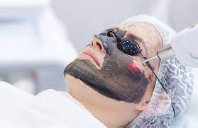 CARBON LASER PEEL | Facial Peel &amp; Treatment | Introlift Medical Spa