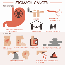 Signs and symptoms of gastrointestinal tract. What Are The Symptoms Of Stomach Cancer Quora