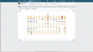 Dental Charting Software For Dental Practice Dentrix Ascend