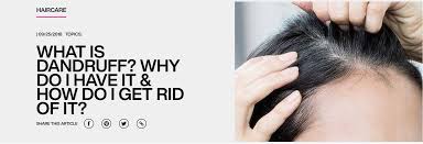 what causes dandruff how to get rid