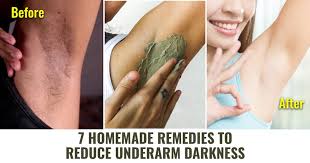 reduce underarm darkness
