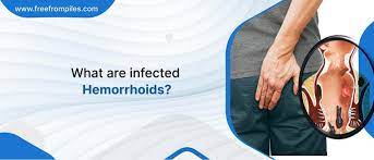 what is infected hemorrhoids