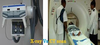 Difference Between X Ray And Ct Scan With Comparison Chart