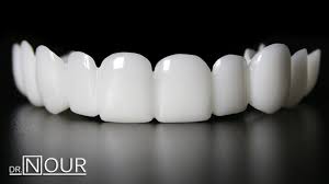 ת×צ×ת ת××× × ×¢××ר Ø§ÙØ§Ø³ÙاÙ