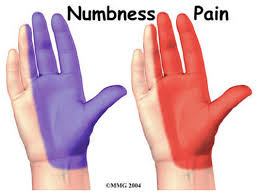 Image result for تنگی کانال مچ دست