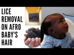 Pediculosis is the term for an infection with head lice. 5 Months Old Baby With Head Lice How I Treated It Story Time Youtube