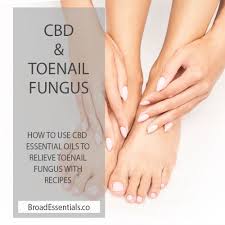 toenail fungus with cbd infused