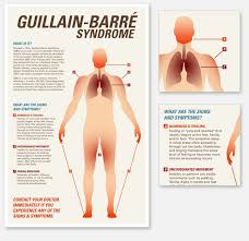 It can cause muscle weakness, reflex loss, and numbness or tingling in parts of your body. Guillain Barre Infographic Vj Diaz Visual Designer Guillain Barre Syndrome Barre Physical Therapist Assistant