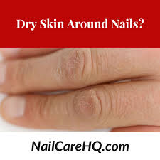 how do i stop hard dry skin on hands