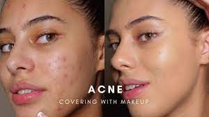 cover acne with makeup base routine
