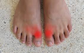 common causes of big toe joint pain